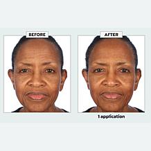 SKINN Non-Negotiables DermAppeal® Microdermabrasion Beauty Treatment