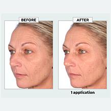 SKINN Non-Negotiables DermAppeal® Microdermabrasion Beauty Treatment