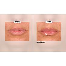 SKINN Non-Negotiables Lip 6x Lip Amplifying Serum Auto-Ship®