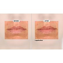 SKINN Non-Negotiables Lip 6x Lip Amplifying Serum