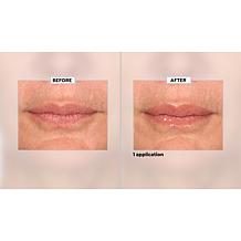 SKINN Non-Negotiables Lip 6x Lip Amplifying Serum