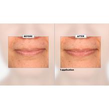 SKINN Non-Negotiables Lip 6x Lip Amplifying Serum