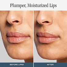 SKINN Non-Negotiables Lip 6x Lip Amplifying Serum