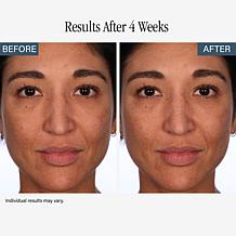 SKINN Non-Negotiables Resurfacing Pads & Headband Duo - Auto-Ship®