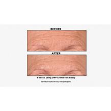 SKINN Supersize DWP Protocol Creme Reverse Intensive