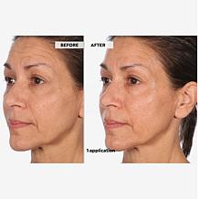 SKINN Supersize Luminous Facial Oil and Reusable Gold Eye Patches 