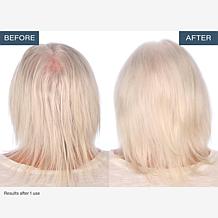 SKINN TrichoLab Volumizing Shampoo & Nourishing Conditioner