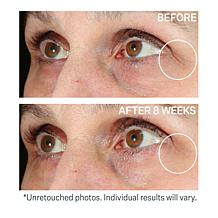StriVectin Contour Restore Moisturizing Eye Balm