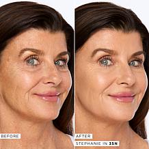 tarte shape tape™ Radiant Medium Coverage Concealer - Fair