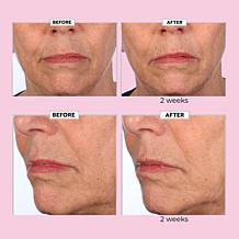 The Beauty Spy Dr. Tree Jumbo Dear Loose Skin Super Collagen Cream