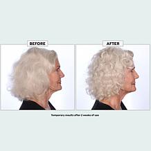 The Beauty Spy Dr. Tree PDRN Treatment
