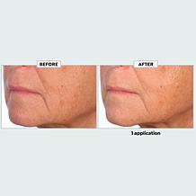 The Beauty Spy Dr. Tree Super Collagen PDRN Wrinkle Patches