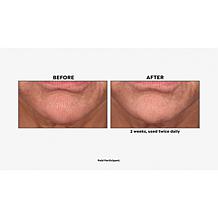 The Beauty Spy Neogen SURMEDIC™ Super Peptide Collagen Serum