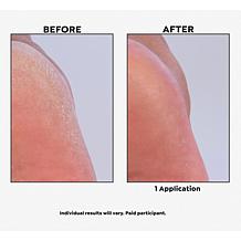 The Beauty Spy Richenna Jumbo EZ Body Foot Peel