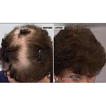 TRUHAIR® Color & Lift Thickening Fibers - Medium Brown