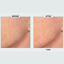 TruRitual Dermaplaning Kit with Replacement Blades