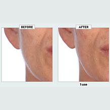 TruRitual Dermaplaning Kit with Replacement Blades