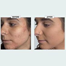 Youngblood
Loose Mineral Foundation & Brush Set