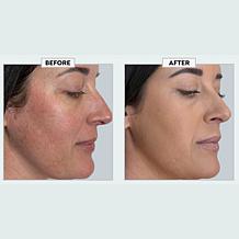 Youngblood
Loose Mineral Foundation & Brush Set