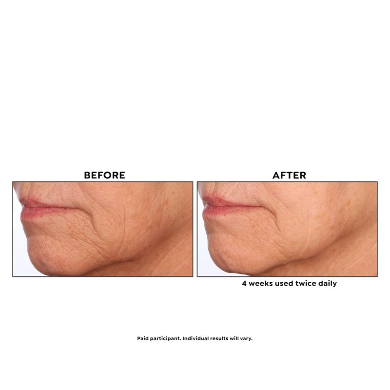 asam resveratrol serum