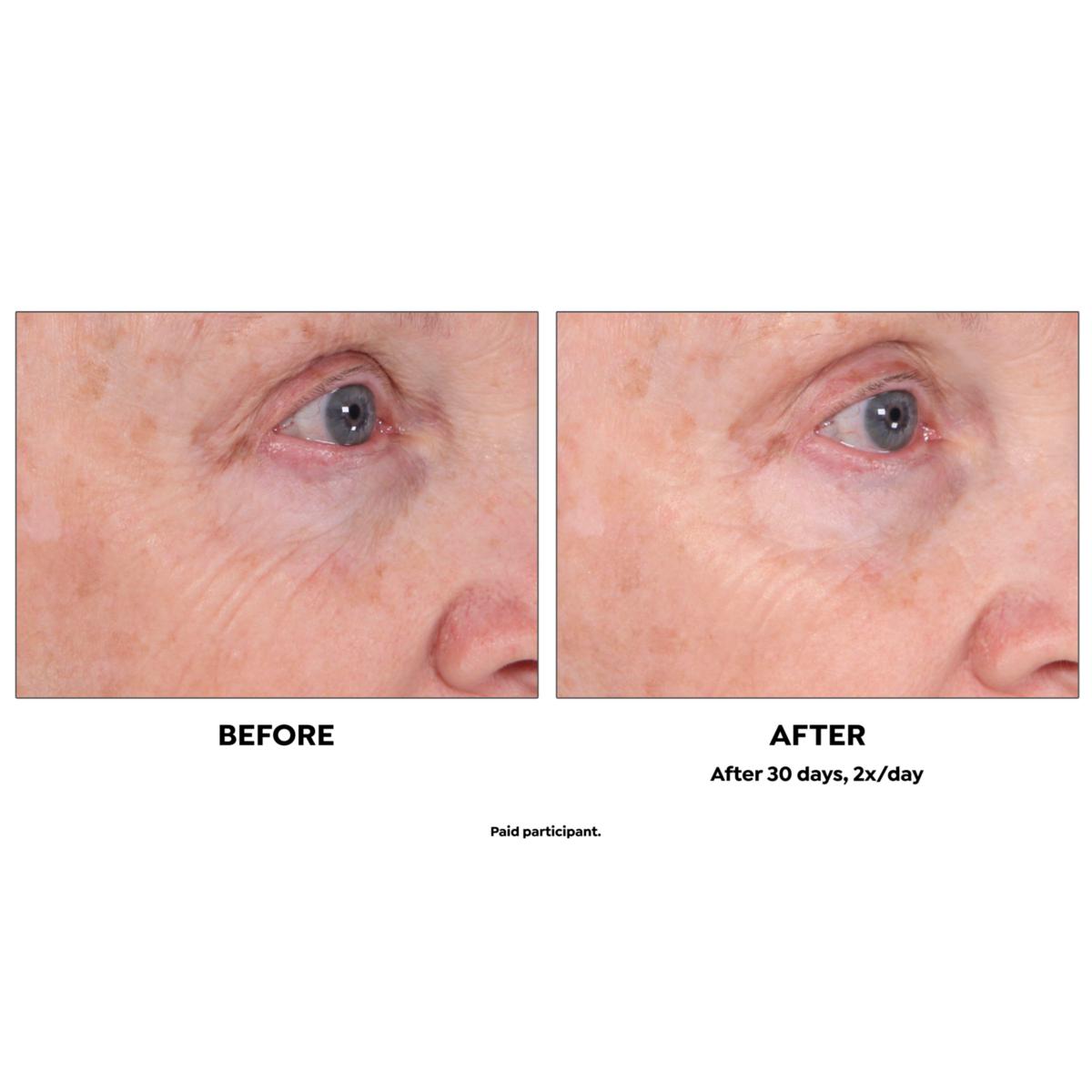 Active Argan 1.7 oz. 24K Stem Cell Eye Cream | HSN