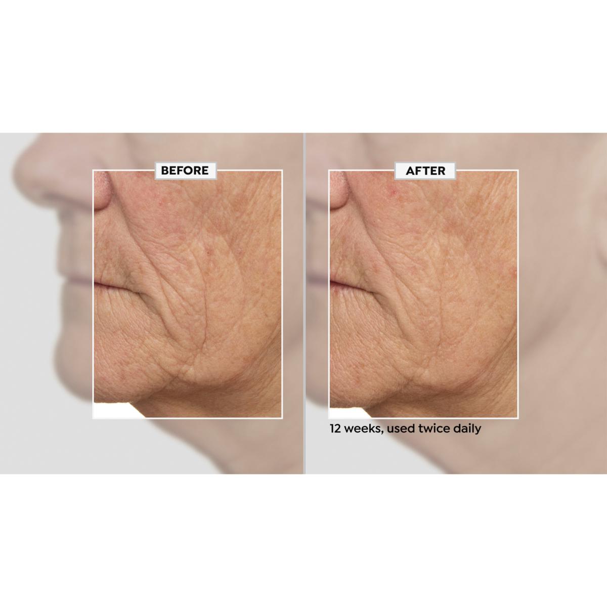 Beekman 1802 Milk RX Advanced Better Aging 2-piece Serum & Mask