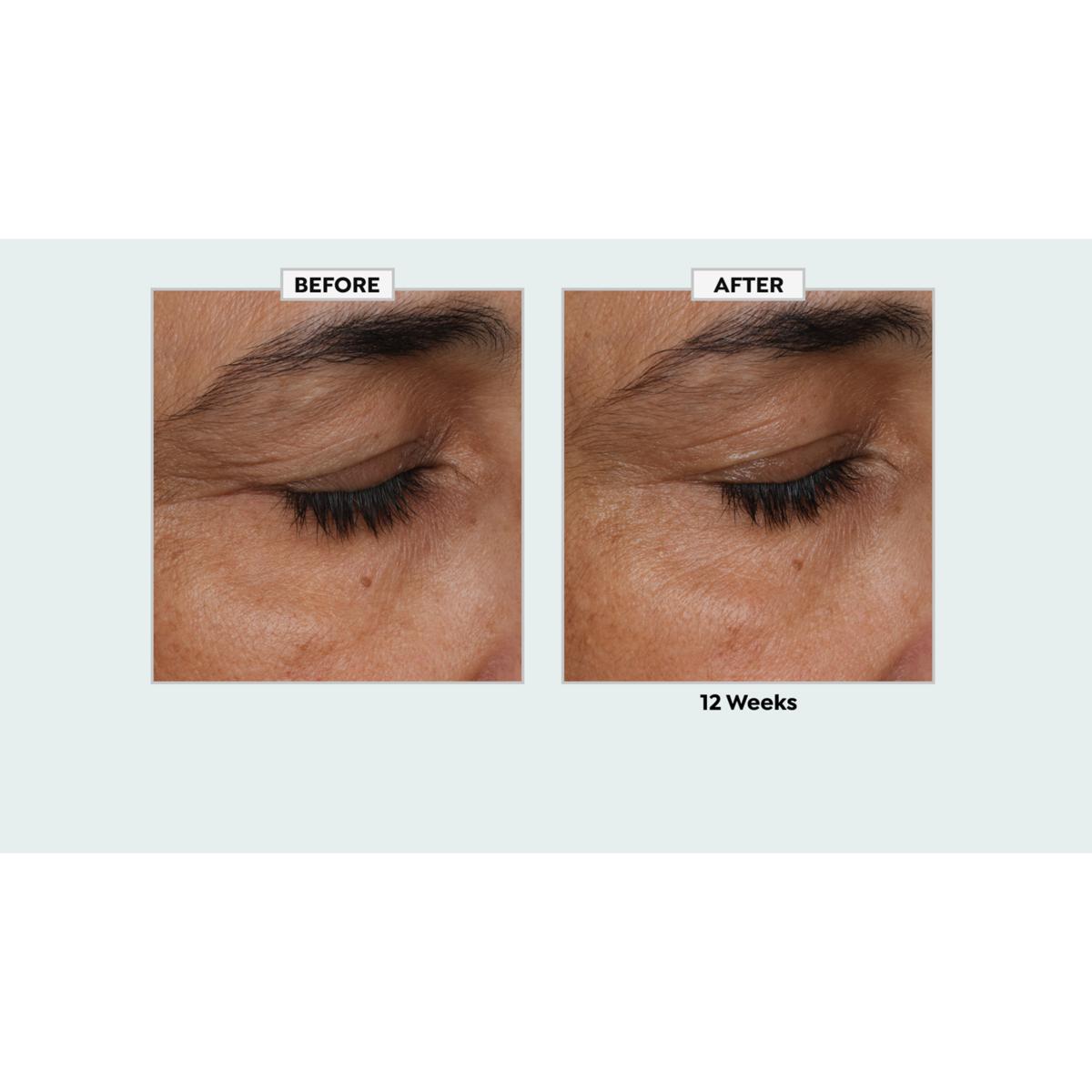 Bé フェイスクリーム 2個セット Beekman 1802 Milk RX Better Aging Dual Eye Treatment 2-pack | HSN