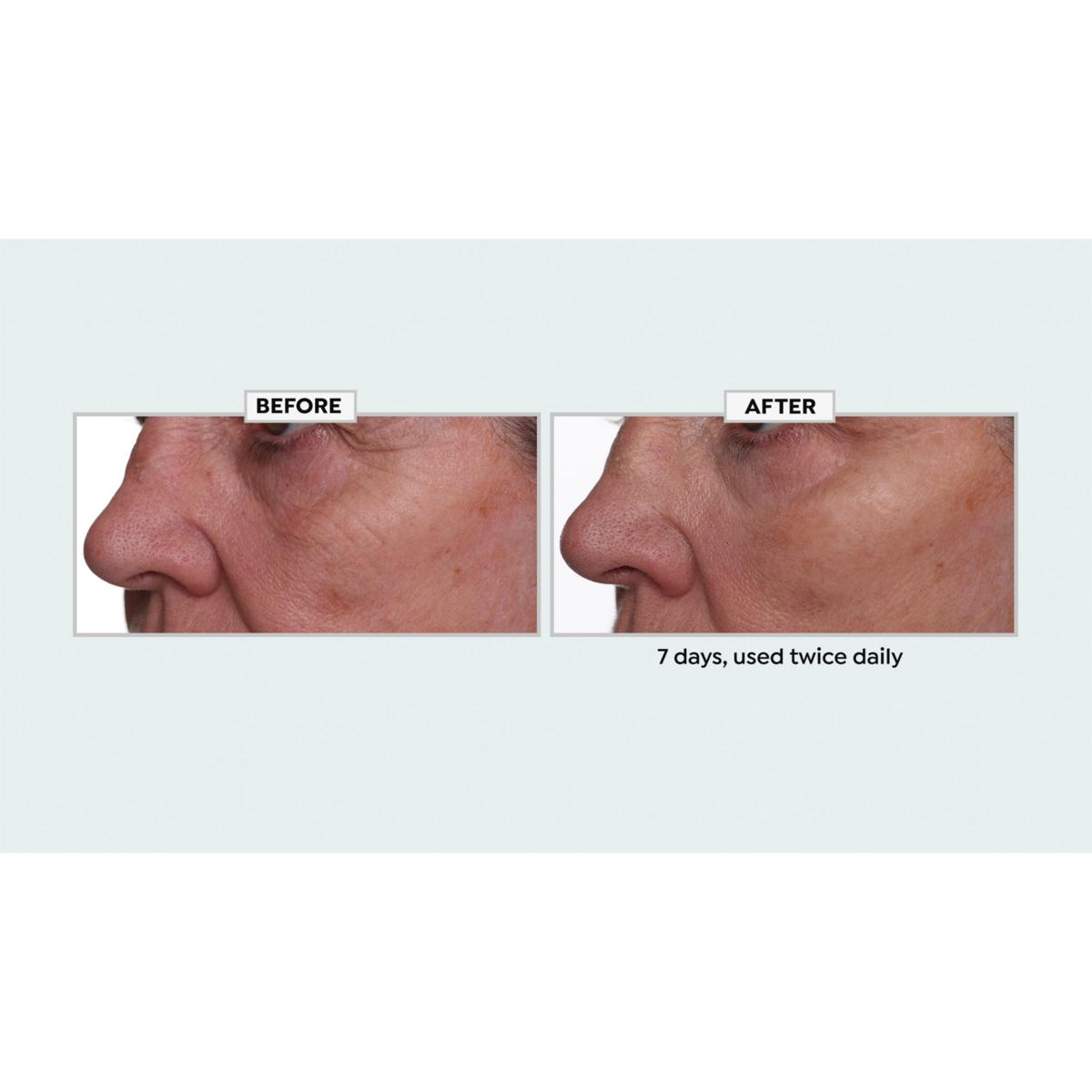 Nakery Beauty Lift-TOX 360 Firming Eye Lift Treatment Cream