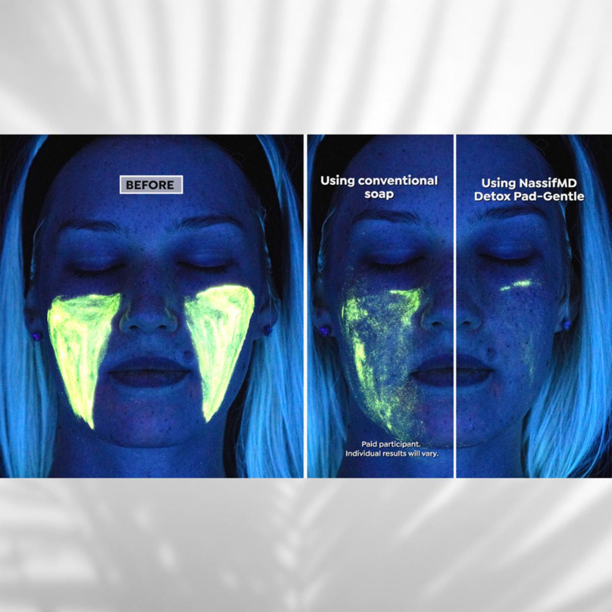 NassifMD® 3-pack 60-count Original Detox Pads - 8980636 | HSN